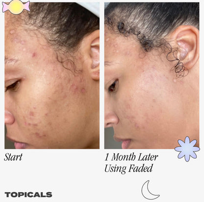 Topicals Faded Serum for Dark Spots & Discoloration